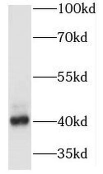 MAPRE2 Rabbit Polyclonal Antibody