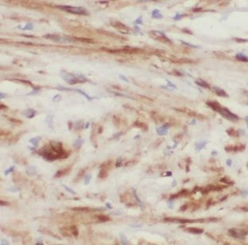 MARCKS Antibody