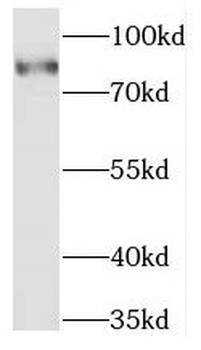 MARK2 Rabbit Polyclonal Antibody