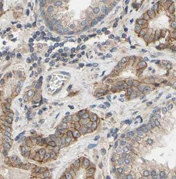 MARK2 Rabbit Polyclonal Antibody