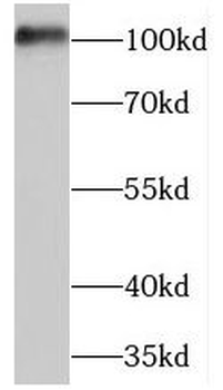 MARS1 Rabbit Polyclonal Antibody
