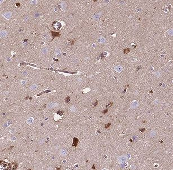 MAS1L Rabbit Polyclonal Antibody