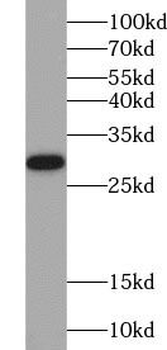 CMA1 Rabbit Polyclonal Antibody