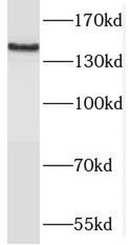 MAST3 Rabbit Polyclonal Antibody
