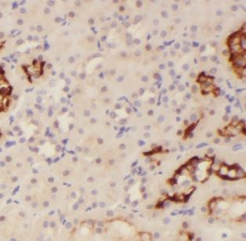 MAST3 Rabbit Polyclonal Antibody