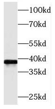 MAT2B Rabbit Polyclonal Antibody