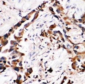 MAT2B Rabbit Polyclonal Antibody