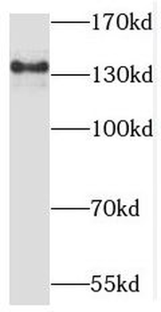 MATN2 Rabbit Polyclonal Antibody