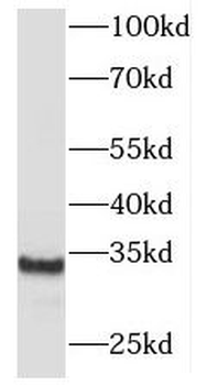 MBD3 Rabbit Polyclonal Antibody