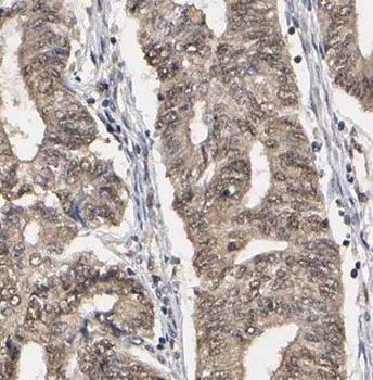 MBD3 Rabbit Polyclonal Antibody