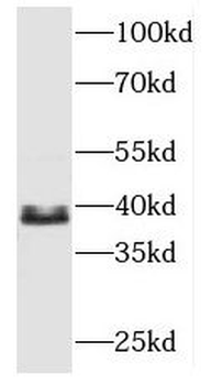 MBNL3 Rabbit Polyclonal Antibody