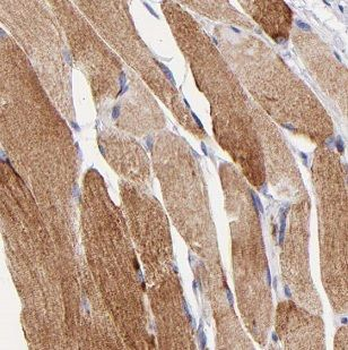MBNL3 Rabbit Polyclonal Antibody