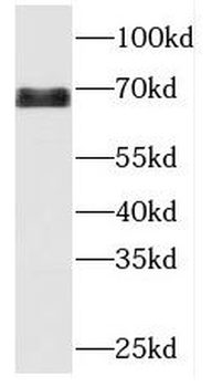 MBTD1 Rabbit Polyclonal Antibody