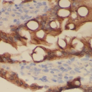 MC3R Rabbit Polyclonal Antibody