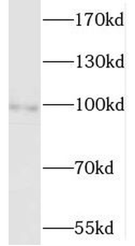 MCC Rabbit Polyclonal Antibody