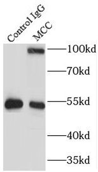 MCC Rabbit Polyclonal Antibody