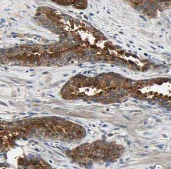 MCC Rabbit Polyclonal Antibody