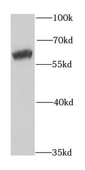 MCCC2 Rabbit Polyclonal Antibody