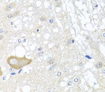 MCCC2 Rabbit Polyclonal Antibody