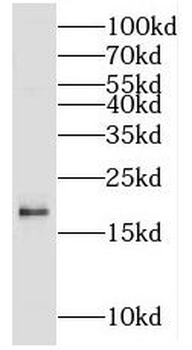 MCEE Rabbit Polyclonal Antibody