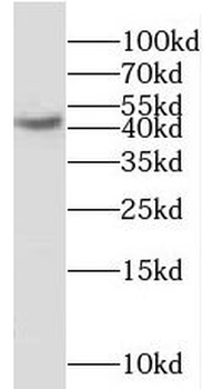MCHR1 Antibody