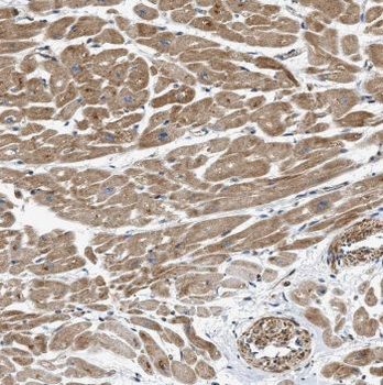 MCHR1 Antibody
