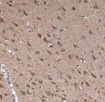 MCHR1 Antibody