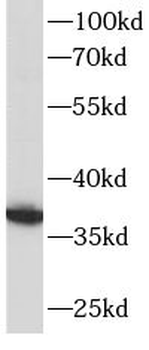 MCL1 Mouse Monoclonal Antibody