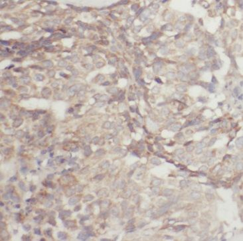 MCL1 Mouse Monoclonal Antibody