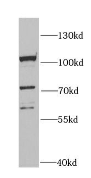 MCM4 Antibody