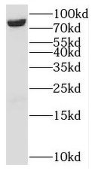 MCM7 Rabbit Polyclonal Antibody