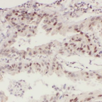 MCM7 Rabbit Polyclonal Antibody