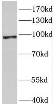 MCM8 Rabbit Polyclonal Antibody