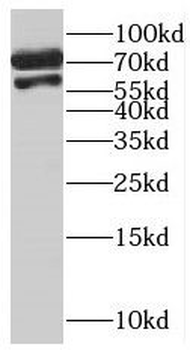 MCMBP Rabbit Polyclonal Antibody