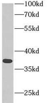 MDH1 Antibody