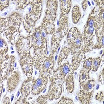 MDH2 Rabbit Polyclonal Antibody