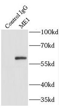 ME1 Antibody