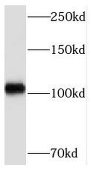 MED15 Antibody