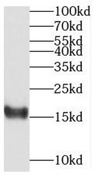 MED31 Rabbit Polyclonal Antibody