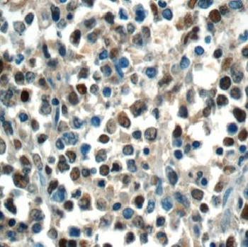 BORCS8 Rabbit Polyclonal Antibody