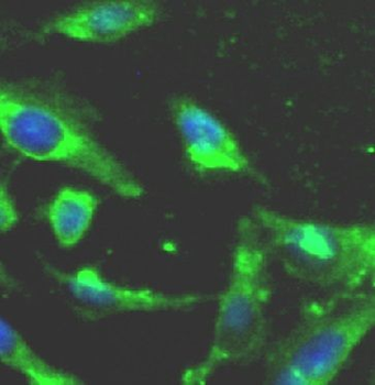 MAP2K3 Rabbit Polyclonal Antibody