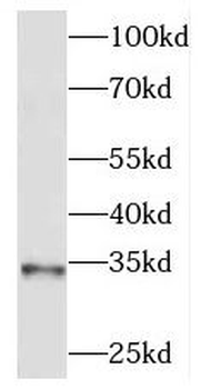MEST Rabbit Polyclonal Antibody