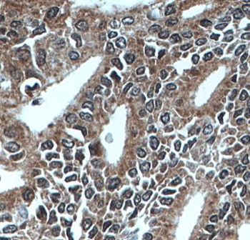 MEST Rabbit Polyclonal Antibody