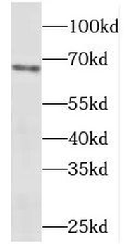 METAP2 Rabbit Polyclonal Antibody
