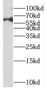 METTL16 Rabbit Polyclonal Antibody