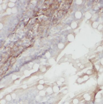 METTL16 Rabbit Polyclonal Antibody