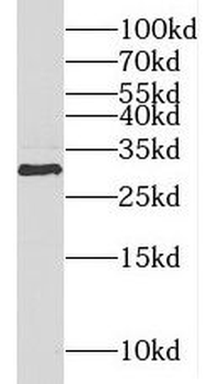 METTL1 Antibody