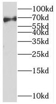 MEX3C Rabbit Polyclonal Antibody