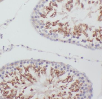 MEX3C Rabbit Polyclonal Antibody