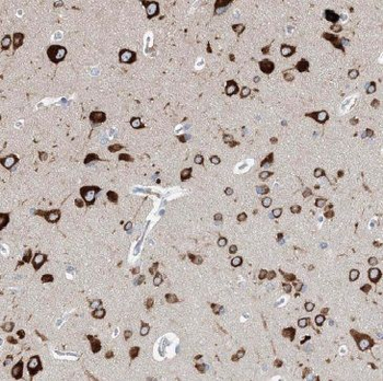 MFF Rabbit Polyclonal Antibody